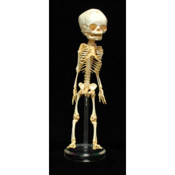 Life Size Human Fetus sold Skeleton